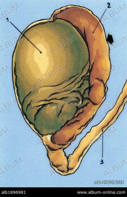 Human male reproductive system. Testis without the scrotal sac. 1 ...