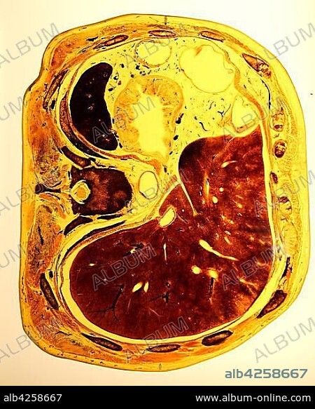 Plastinate, cross section through human abdomen, Body Worlds, Menschen Museum, Berlin, Germany, Europe.