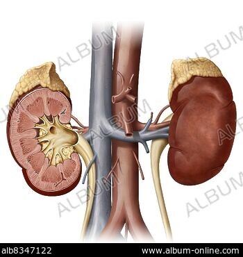 A cystocele is also known as a bladder - Stock Illustration