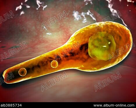 clostridium tetani electron micrograph