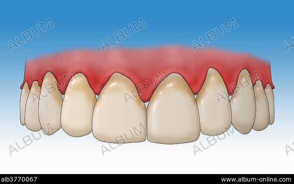 GUMS Stock Photos Illustrations and Images Album