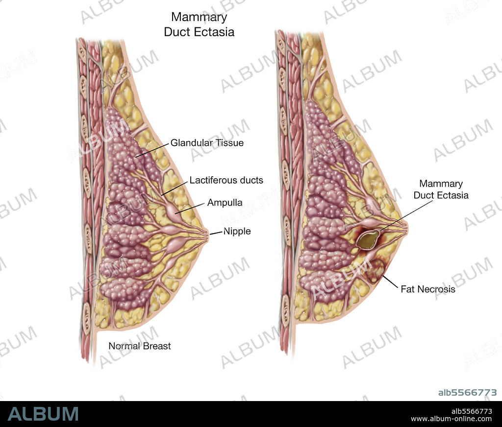Cross Section of Female Breast Anatomy Mammary Boob Body Organs