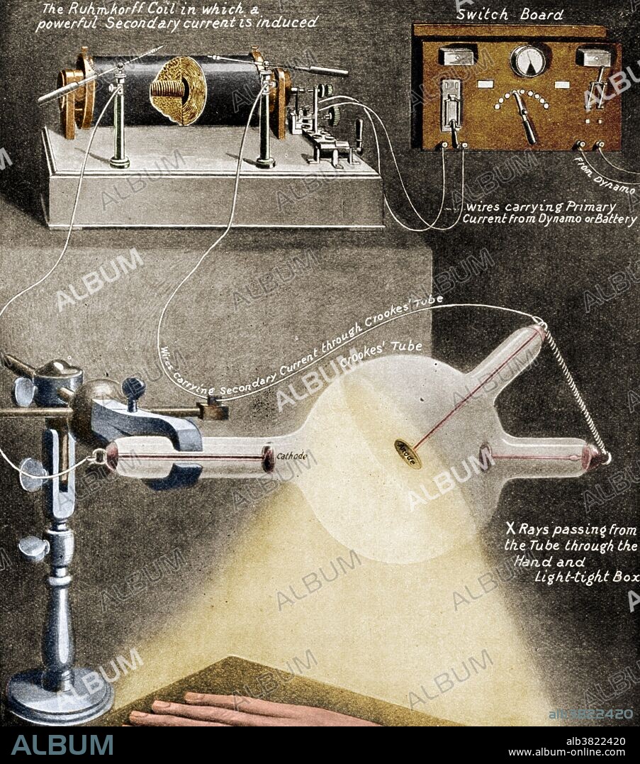 Crookes tube. A diagram showing the apparatus being used to X-ray a hand, 1912. Wilhelm Rontgen discovered X-rays using the Crookes tube in 1895. The Crookes tube was a forerunner to the modern cathode ray tube and television. Crookes tubes were used by British physicist Sir William Crookes from 1878 to investigate cathode rays. He found that the rays, which are actually beams of electrons, made glass fluoresce. Crookes also found that the cathode rays could be bent by applying a magnetic field. The discovery that cathode rays were charged led directly to J.J. Thompson's discovery of the electron in 1897.