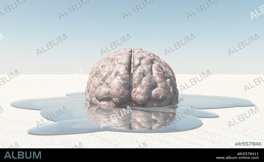 3D rendering of a human brain melting.