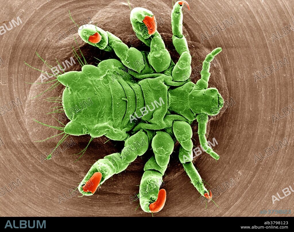 Scanning electron micrograph of ventral view of pubic louse (Phthirus pubis). Supplied by David Gregory & Debbie Marshall, courtesy of Wellcome Images.