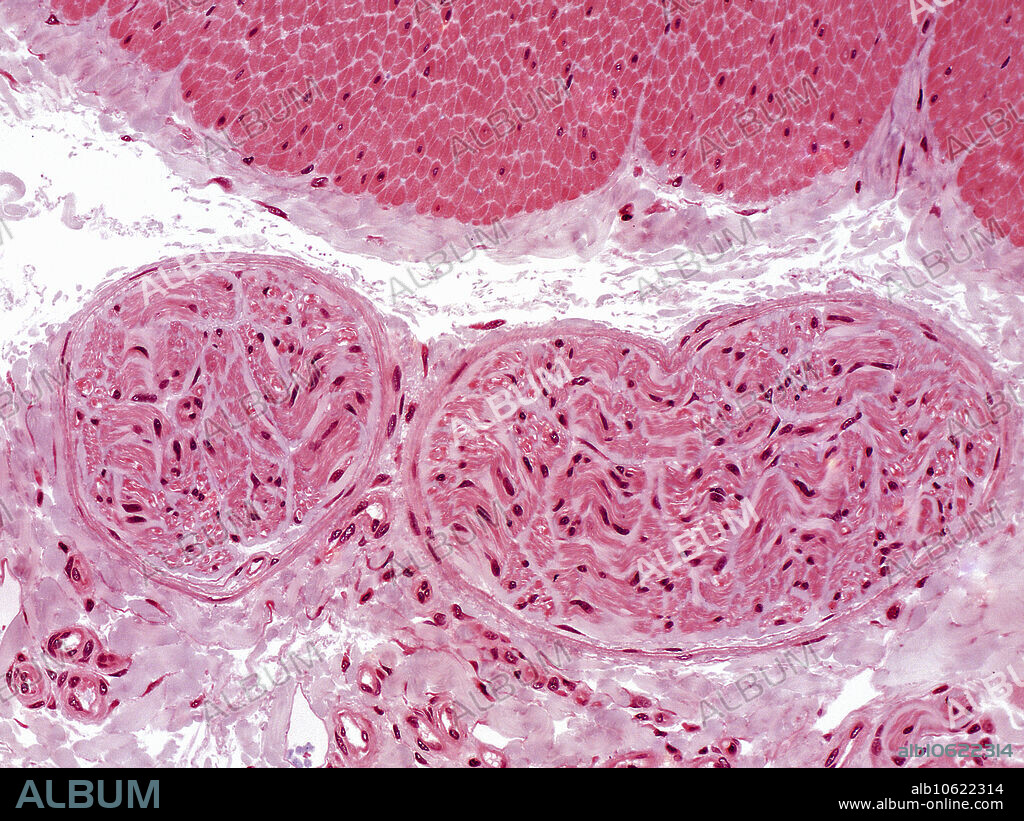 Light micrograph of the colon, showing adventitia with nerves. 1.5 section, HE stain, Magnification: 160X.