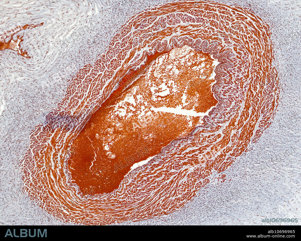 Reproductive system; female; umbilical cord; human. Light micrograph. Magnification = 30x. Mallory Azan Stain.