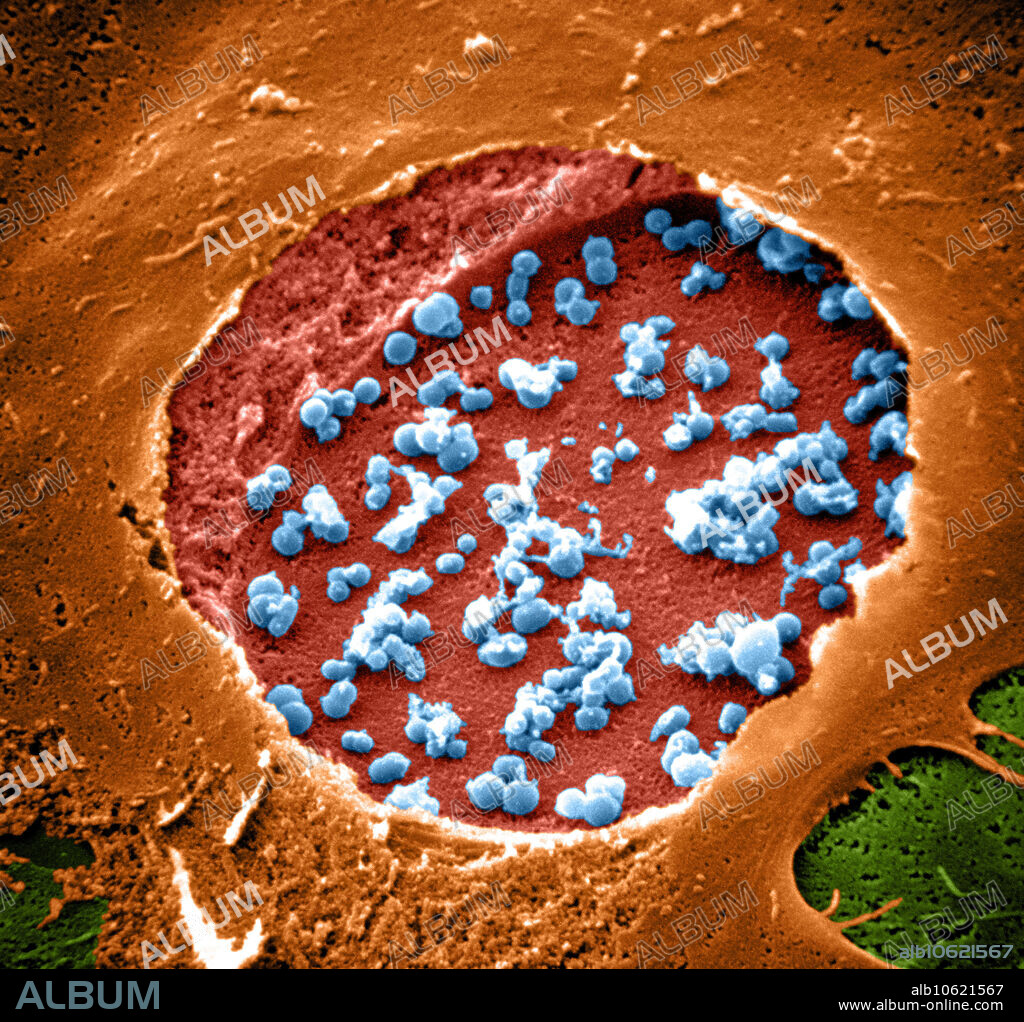 Color enhanced scanning electron micrograph (SEM) of chlamydia, the most common bacterial sexually transmitted disease in humans. Chlamydia are obligate intercellular bacteria. After infection, chlamydia replicate in a large vesicle inside the cell. Here the vesicle has been broken open revealing chlamydia. (Enhancement of BL2967).