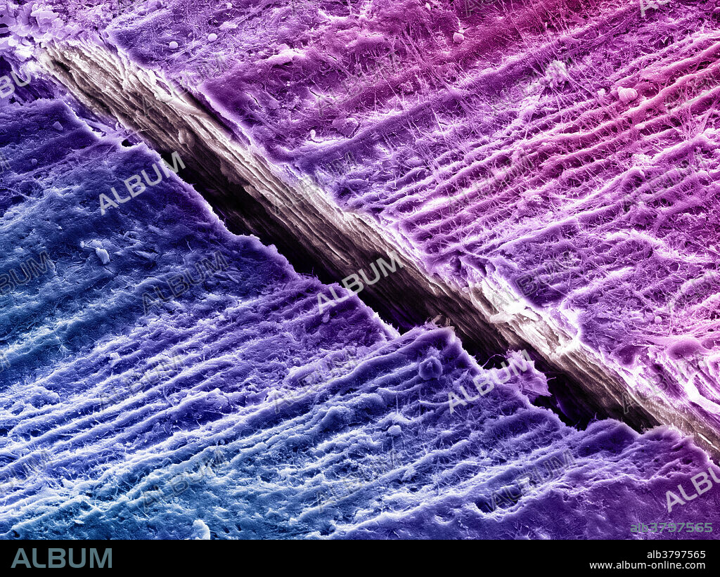 Human Tooth Dentine, SEM - Album alb3797565