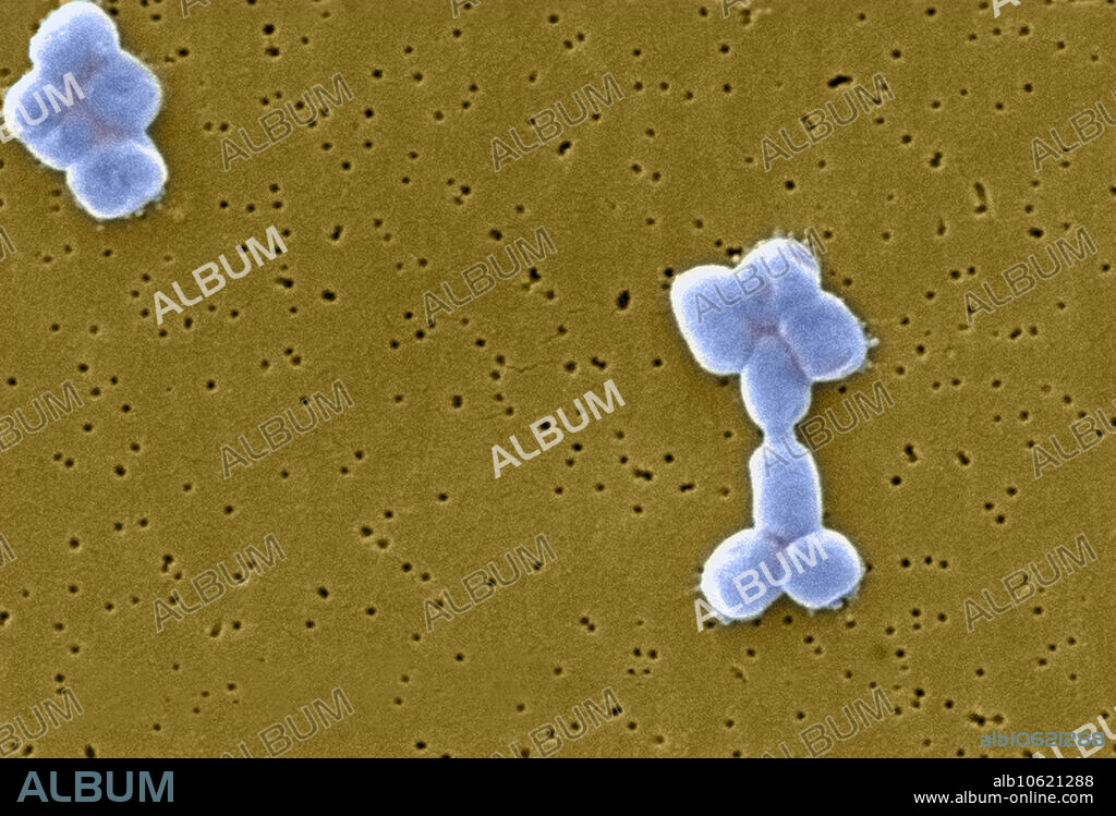 Scanning Electron Micrograph (SEM) of Acinetobacter baumannii. This aerobic gram-negative, non-motile bacteria are normal flora on the skin. But because A. baumannii has developed substantial antimicrobial resistance, it is an emerging cause of nosocomial infections in hospitals, responsible for pneumoniae, hemopathic and wound infections. Magnification of 12739x.