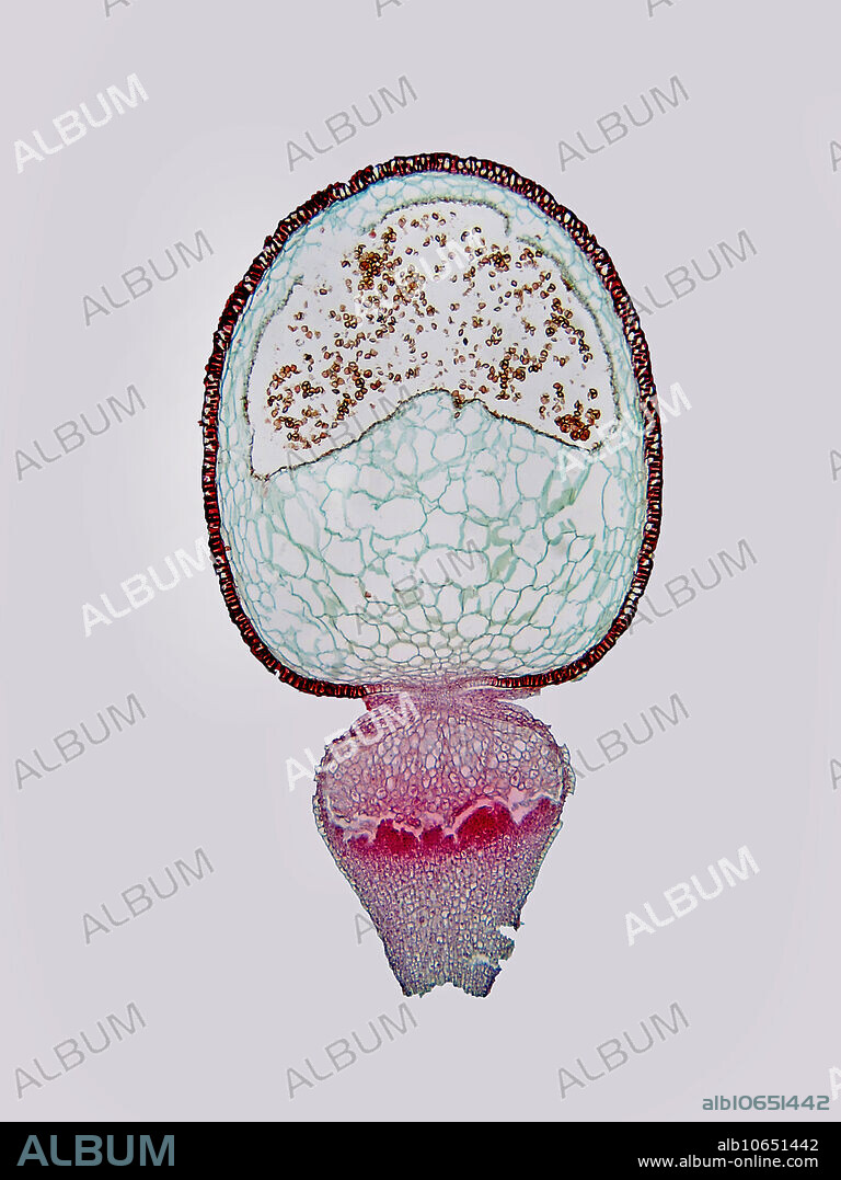 Light micrograph (LM) of a Sphagnum sporophyte capsule, showing enclosed spores. Magnification: 28x when printed at 10 cm.