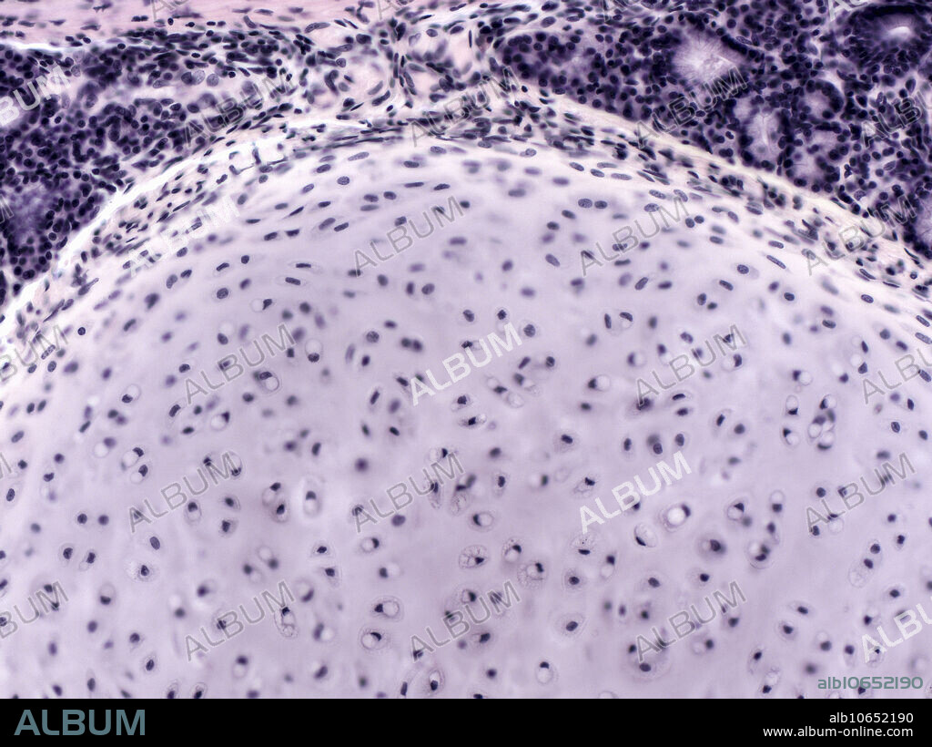 Light micrograph showing tracheal (hyaline) cartilage. H and E stain of human tissue; magnification: 160X.