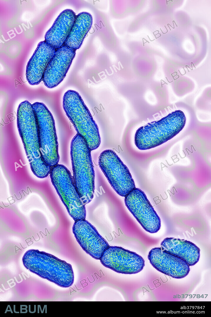 Escherichia coli bacterium. Some strains of Escherichia coli are the cause of various diseases : diarrhoea, gastroenteritis, urinary infection, meningitis, septicemia. Colorization and HDRI treatments on a optical microscopy X 1000.