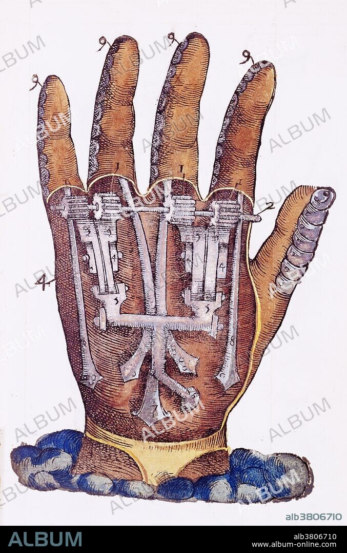 Woodcut, 1564. Hand with mechanical apparatus by Ambroise Pare. Pare (1510-1590) was a French surgeon, anatomist and inventor. He was royal surgeon for kings Henry II, Francis II, Charles IX and Henry III and is considered one of the fathers of surgery and modern forensic pathology. He was a leader in surgical techniques and pioneered modern battlefield wound treatment. Battlefield medicine is the treatment of wounded soldiers in or near an area of combat. Civilian medicine has been greatly advanced by procedures that were first developed to treat the wounds inflicted during combat. Pare introduced the ligature of arteries instead of cauterization during amputation. He believed that phantom pains occurred in the brain. He contributed to the practice of surgical amputation and the design of limb prostheses.