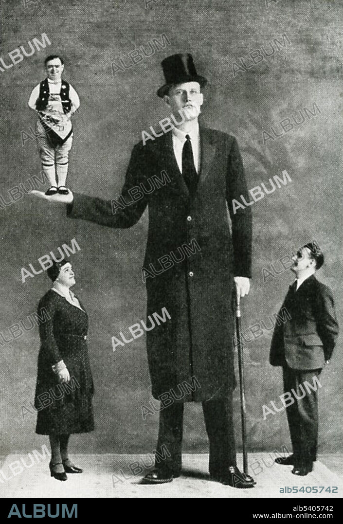 A photograph of Albert Johan Kramer, a giant, holding Fred Aslett, a dwarf. Kramer is 8 ft 9 3/4 inches; Aslett is 2ft 4 inches. The woman and man are of normal height. Gigantism is a rare disorder resulting from increased levels of growth hormone before the fusion of the growth plate, which usually occurs at some point soon after puberty. This increase is most often due to abnormal tumor growths on the pituitary gland. Dwarfism can result from many medical conditions, each with its own separate symptoms and causes. Extreme shortness in humans with proportional body parts usually has a hormonal cause, such as growth-hormone deficiency, once called pituitary dwarfism. Two disorders, achondroplasia and growth hormone deficiency, are responsible for the majority of human dwarfism cases.