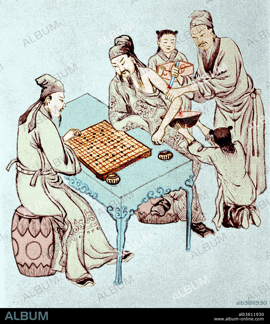 Surgeon Hua Tuo operating on the war hero Juan Kung for necrosis of arm resulting from a wound in battle. The game of Go is being played to detract the patient's attention. Hua Tuo (c. 140-208) was an ancient Chinese physician who lived in the late Eastern Han Dynasty. Historical texts record Hua as the first person in China to use anaesthesia during surgery. He used a general anaesthetic combining wine with an herbal concoction. Besides being respected for expertise in surgery and anaesthesia, Hua Tuo was famous for his abilities in acupuncture, moxibustion, herbal medicine, and medical Daoyin exercises. He was eventually elevated to the status of God of Medicine.