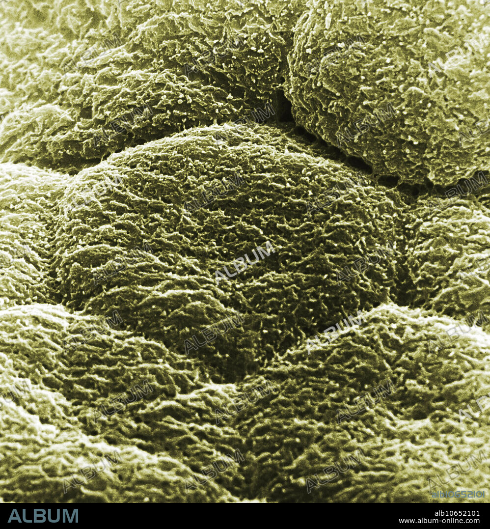 Scanning electron micrograph of human bladder.