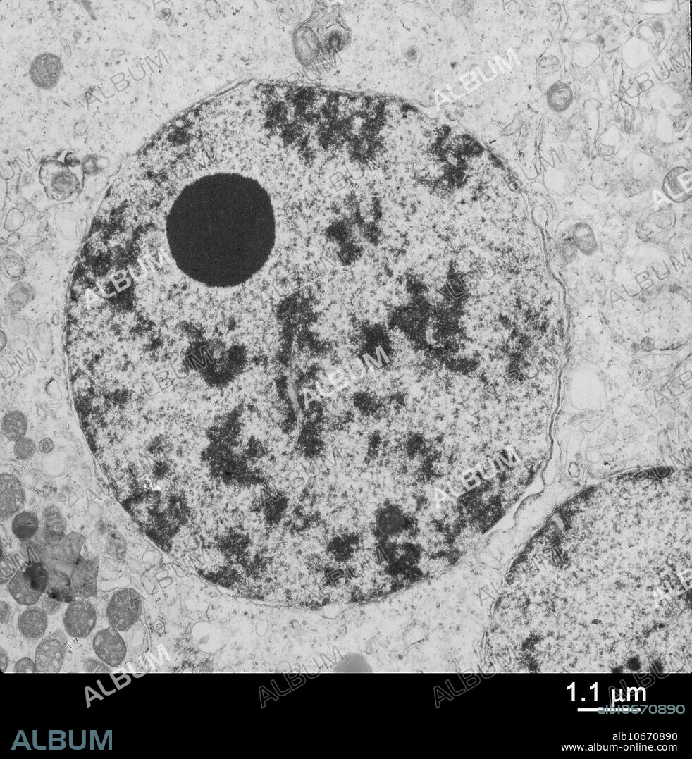 Transmission electron micrograph (TEM) of human testis nucleus in prophase of meiosis I, the pairing of homologous chromosomes. Synaptonemal complex is visible as a tri-partite 'strand' in the centre of the nucleus. Note also prominent nucleolus. Magnification 7000x.