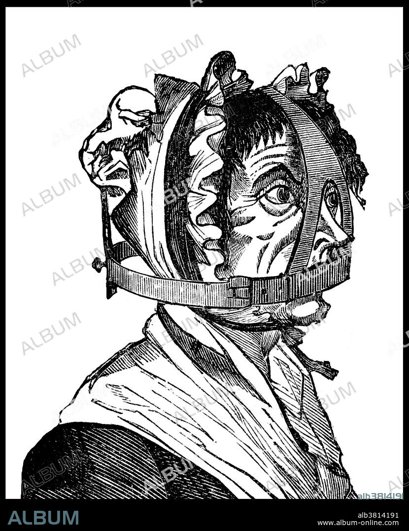 A scold's bridle was an instrument of punishment, as a form of torture and public humiliation. The device was an iron muzzle in an iron framework that enclosed the head. A bridle-bit, about 2 inches long and 1 inch broad, projected into the mouth and pressed down on top of the tongue. Branking was designed as a mirror punishment for shrews or scolds; women of the lower classes whose speech was deemed riotous or troublesome - often women suspected of witchcraft - by preventing such "gossips or scolds" from speaking. Displaying the branks in public was intended to remind the populace of the consequences of any rash action or slander. Whether the person was paraded or simply taken to the point of punishment, the process of humiliation and expected repentance was the same.