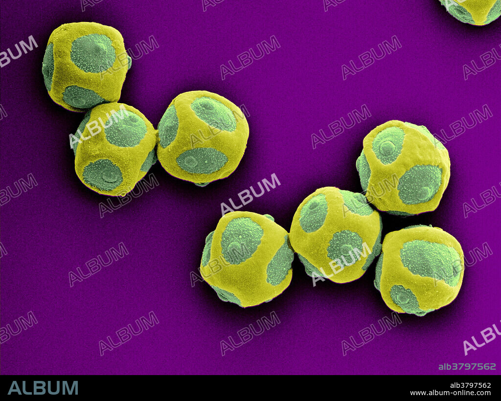 Colour-enhanced Scanning Electron Micrograph (SEM) showing blackcurrant pollen. The blackcurrant (Ribes nigrum) is a woody shrub in the family Grossulariaceae grown for its piquant berries. It is native to temperate parts of central and northern Europe and northern Asia. The fruit is rich in vitamin C, various other nutrients, phytochemicals and antioxidants. Blackcurrants can be eaten raw but are usually cooked in a variety of sweet or savory dishes. Image width 160 micrometers. Magnification: 625x if the image is printed 10 cm wide.