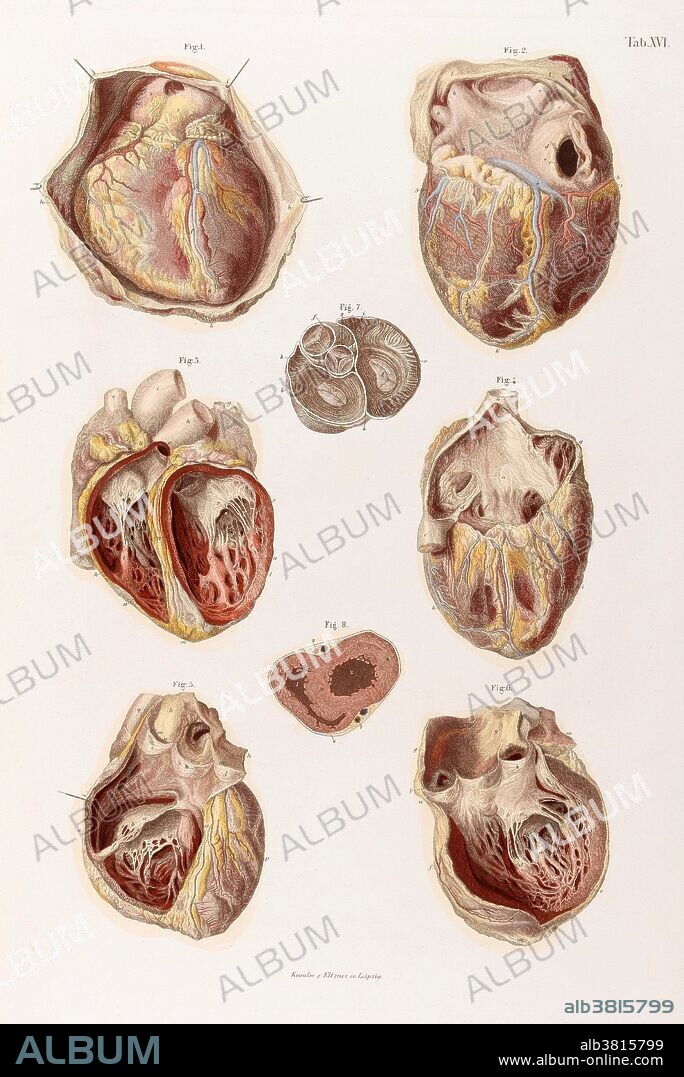 The heart, its cavities and valves, 1878. Fig. 1: Anterior surface of Heart and Pericardial covering; Fig. 2: Posterior surface of Heart, Auricles, and Ventricales; Fig. 3: Internal cavities of Ventricals, anterior view; Fig. 4: Anterior surface of Heart, interior of right auricle exposed; Fig 5: Interior of right Auricle, Ventrical, and Pulmonary Artery; Fig. 6: Exterior of left Ventricle and of Aorta; Fig. 7: Transverse section of Auricles, Aorta, and Pulmonary Artery, immediately above the origins of these vessels, showing the auriculo-ventricular and arterial valves in action; Fig. 8: Transverse section of Ventricles. From "Atlas of human anatomy with explanatory text, containing 38 colored plates," by C.E. Bock, 1878.