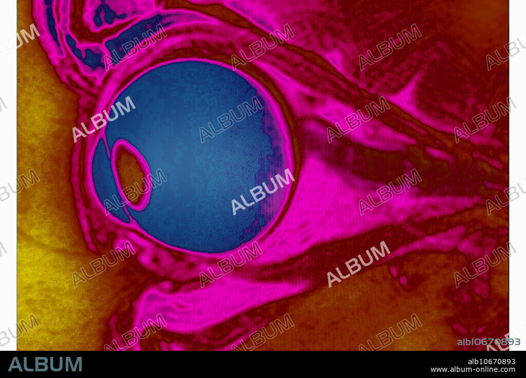 Colour enhanced MRI of a sagittal section of a human eye.