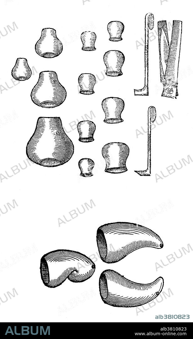 These are vessels for cupping, an ancient practice that has roots at least as far back as Greece and Rome. It has connections to humoral medicine and bleeding. The cup was placed open side down on the patient's body, and then heated, creating a partial vacuum inside the cup that drew blood to the surface of the skin. Bleeding was then started, either with a lancet or a scarifier. The 1585 edition of ParÃ©'s Oeuvres (Collected Works) represents the final summary of his life's work. It has over twelve hundred folio pages, with nearly 400 illustrations drawing upon a lifetime of practice. Four editions of the Oeuvres were published during his lifetime, and this is the last and the most complete. Often his descriptions of difficult cases end with the same simple sentence, "I treated him, but God cured him." Ambroise ParÃ© (1510 - December 20, 1590) was a French surgeon, anatomist, inventor and one of the fathers of surgery and modern forensic pathology.