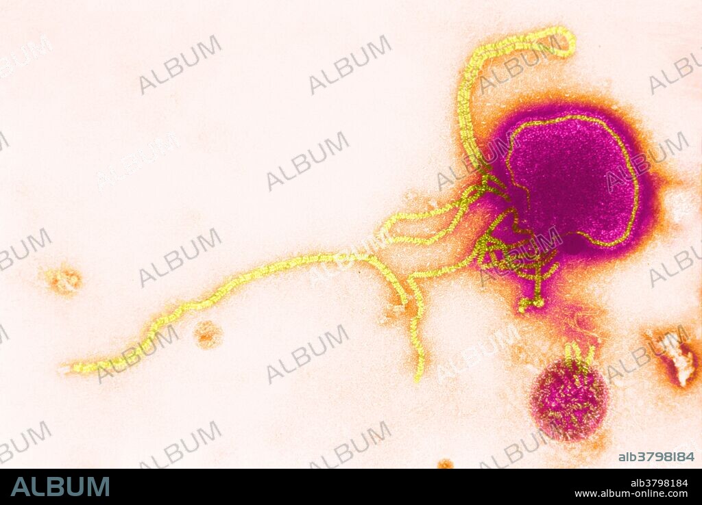 Transmission electron micrograph (TEM) of parainfluenza virus. Human parainfluenza viruses (HPIVs) are the viruses that cause human parainfluenza. HPIVs are a group of four distinct single-stranded RNA viruses belonging to the Paramyxoviridae family. These viruses are closely associated with both human and veterinary disease. The viruses can be detected via cell culture, immunofluorescent microscopy, and PCR. HPIVs remain the second main cause of hospitalization in children under 5 years of age suffering from a respiratory illness.