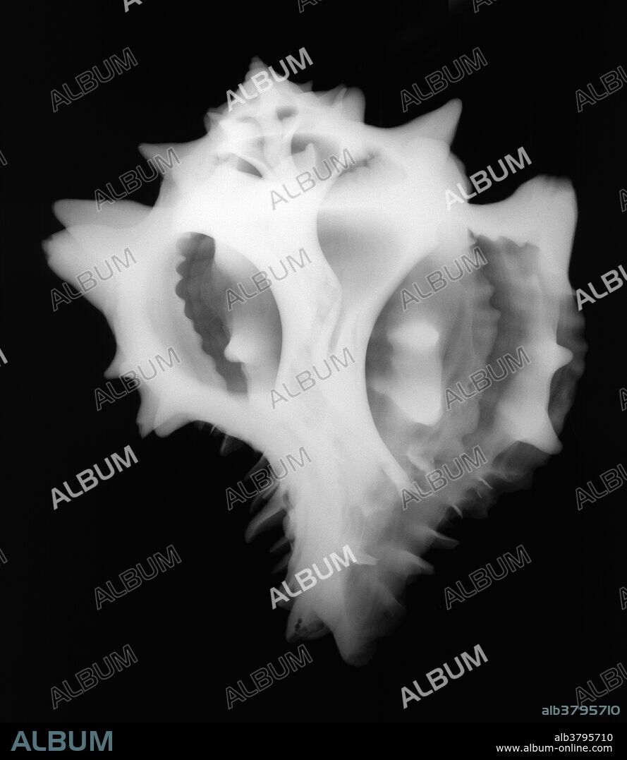 X-ray of a large pink murex (Murex brassica) shell.