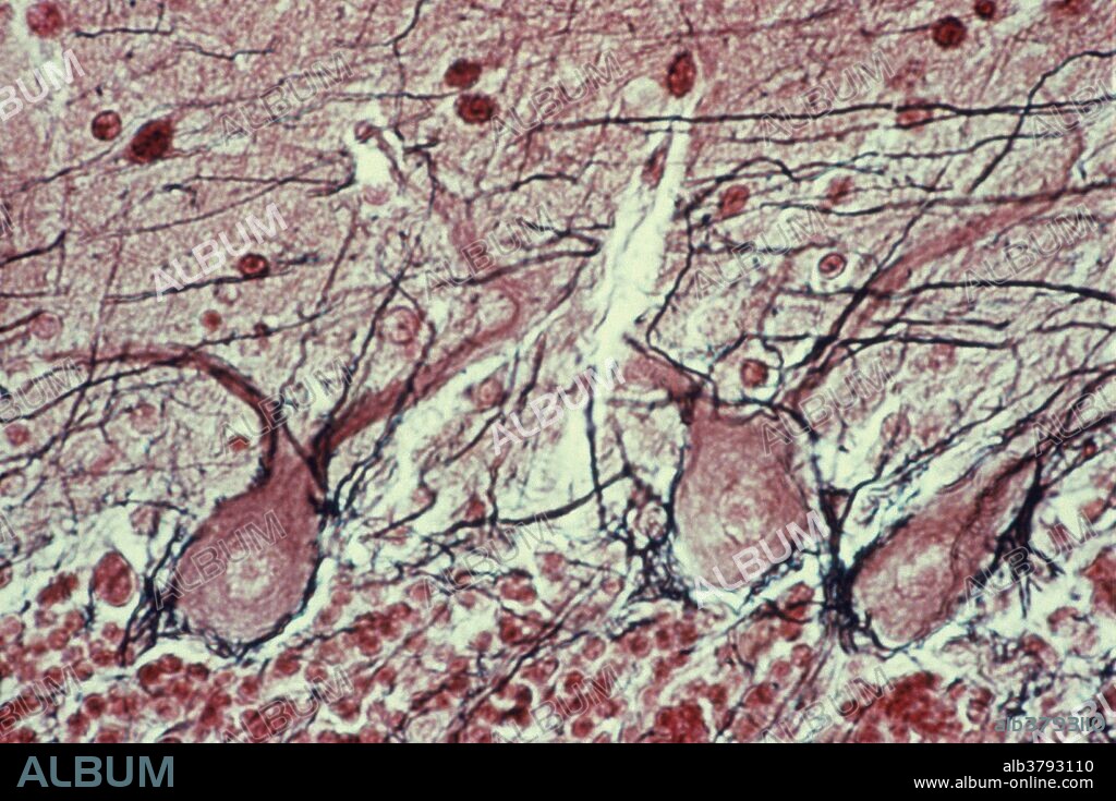 Purkinje cells in the cerebellum. Axons appear black. The layers of the cerebellum consist of the "molecular layer" (outer), "granule cell layer" (inner), and an intervening layer of huge neurons called "Purkinje cells" H & E stain.