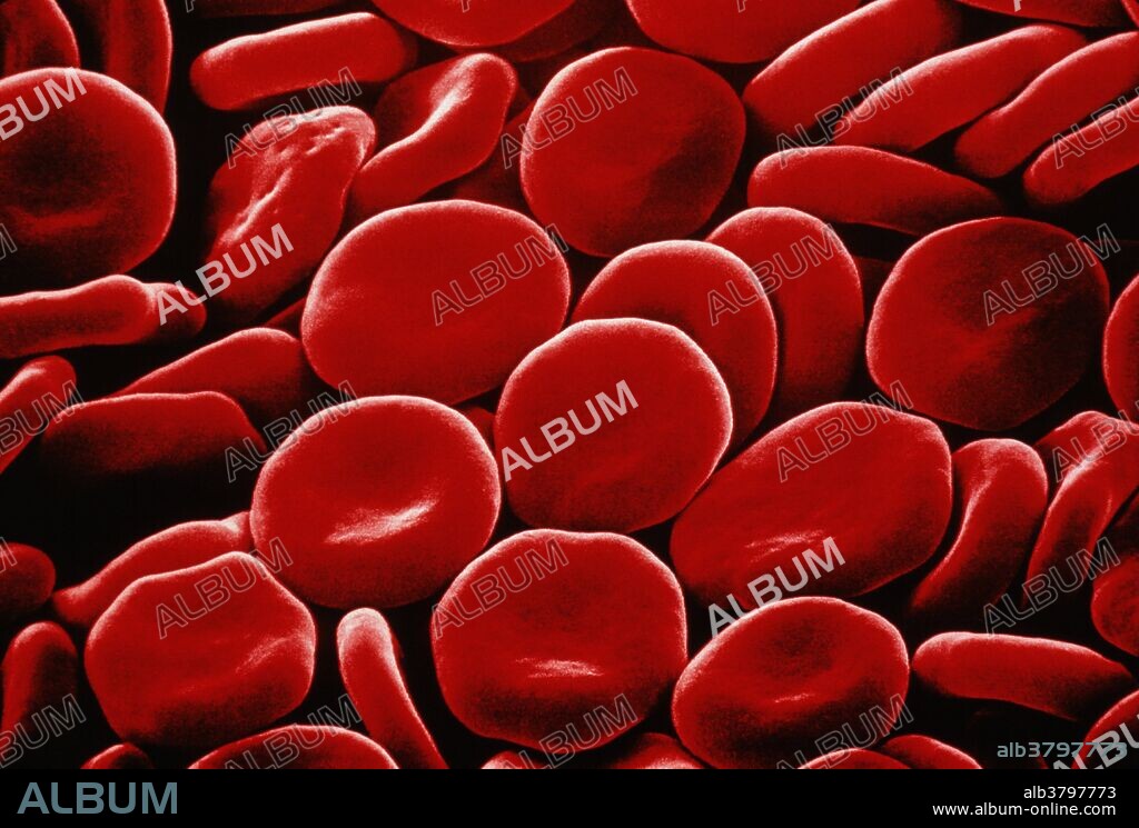 Red blood cells. Colored Scanning Electron Micrograph (SEM) of normal human red blood cells (erythrocytes). These are the most abundant type of cell in the blood. They are rounded and flattened into a biconcave shape, an adaptation which provides the maximum surface area for the exchange of gases. The principal function of red blood cells is to distribute and transport oxygen and carbon dioxide around the body. As the cell matures the nucleus and other internal organelles are lost, and it becomes filled with hemoglobin, a red iron-containing pigment with an efficient capacity to carry oxygen around the body. Magnification: x1350 at 5x7cm size.