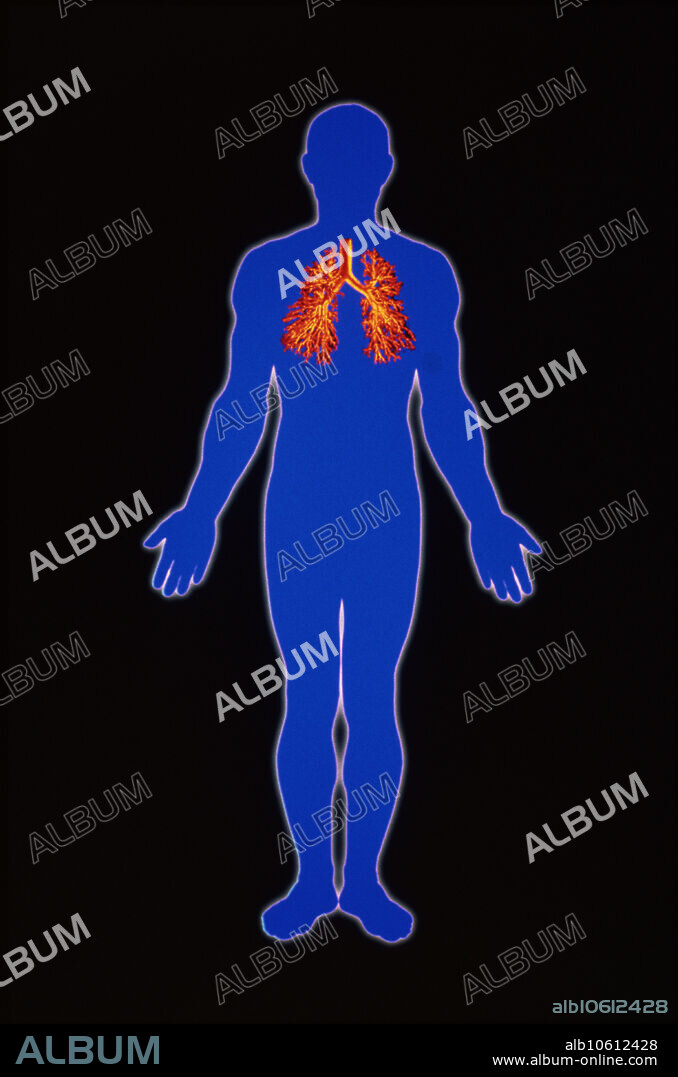 Lung anatomy. Computer artwork of the trachea and bronchiole network of the human lungs, seen in the silhouette of a male human figure. At upper centre the trachea (windpipe) introduces air from the larynx of the throat into the respiratory system. It branches into two bronchi which enter the pair of lungs. Within the lungs the bronchi divide into an internal network of smaller and finer bronchioles. These bronchiole tubes end in tiny balloon-like air sacs called alveoli (not seen). In the alveoli gases are exchanged: inhaled oxygen enters the blood and carbon-dioxide is breathed out. For this respiration process, the lungs are inflated by movement of the diaphragm and ribs.