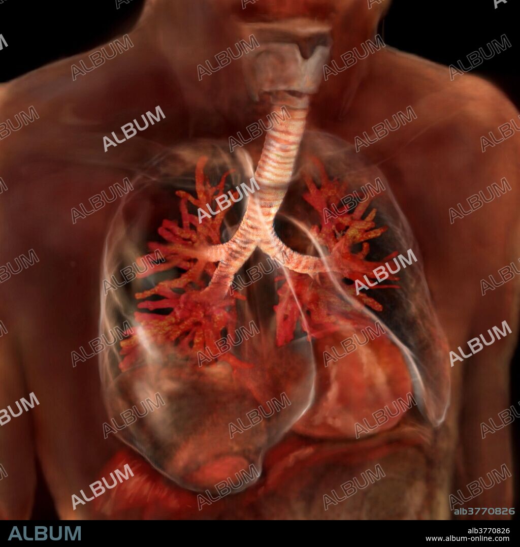 view of the lungs