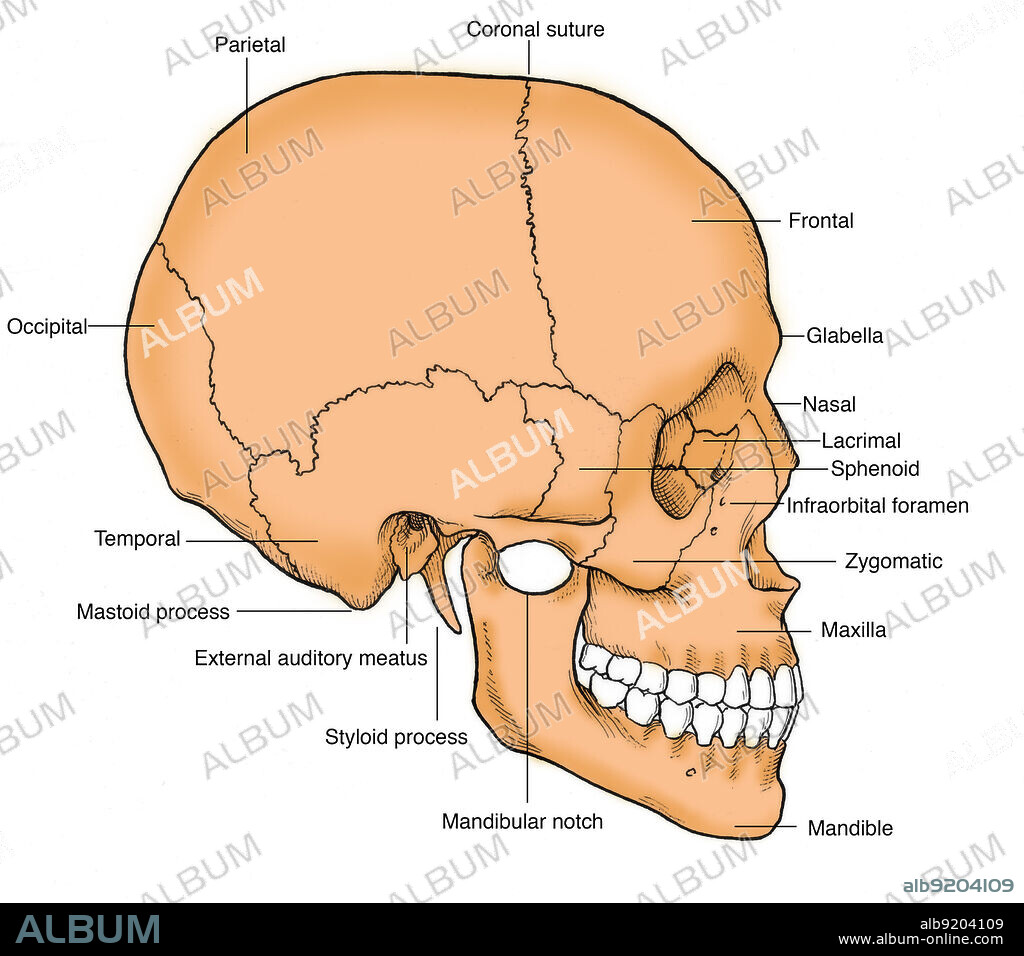 Anatomical illustration of a human skull in profile, showing the various skeletal parts: parietal, coronal suture, frontal, glabella, nasal, lacrimal, infraorbital foramen, zygomatic, maxilla, mandible, mandibular notch, styloid process, external auditory meatus, mastoid process, temporal, and occipital.