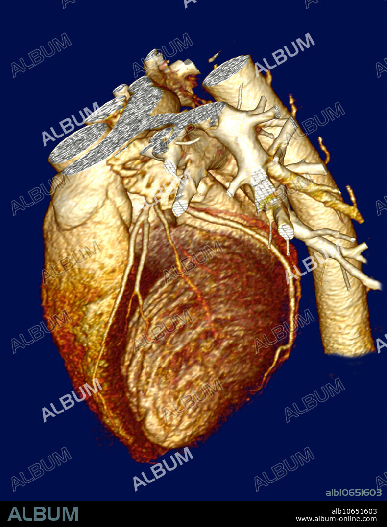 CT Scan, Heart - Album alb10651603