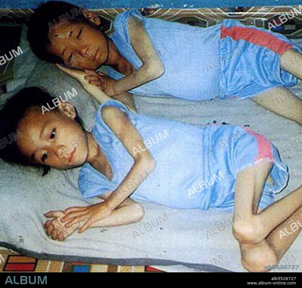 Emaciated brother and sister lie prone at Unsun kindergarten in South  Pyongyang. - Album alb5526727