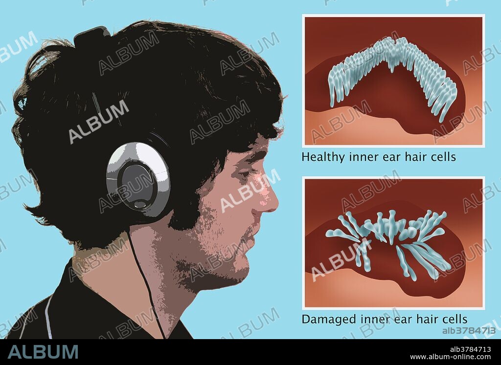 Headphones Hearing Protection or Damage Album alb3784713