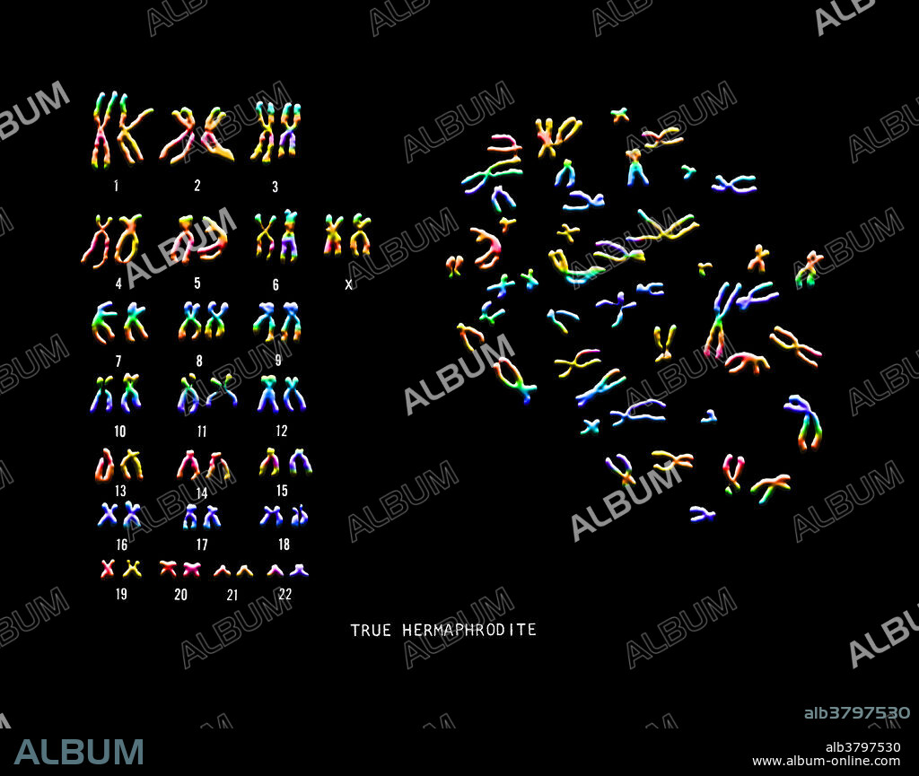 Hermaphrodite Karyotype - Album alb3797530