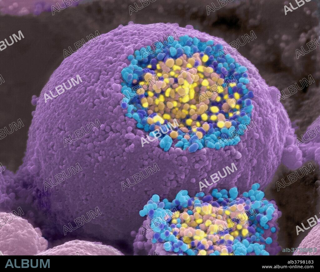 A scanning electron microscope picture of a nerve ending. It has been broken open to reveal vesicles (yellow and blue) containing chemicals used to pass messages in the nervous system. A nerve is an enclosed, cable-like bundle of axons (the long, slender projections of neurons) in the peripheral nervous system. A nerve provides a common pathway for the electrochemical nerve impulses that are transmitted along each of the axons to peripheral organs. Vesicles are a basic tool used by the cell for organizing cellular substances. Vesicles are involved in metabolism, transport, and enzyme storage. They can also act as chemical reaction chambers.