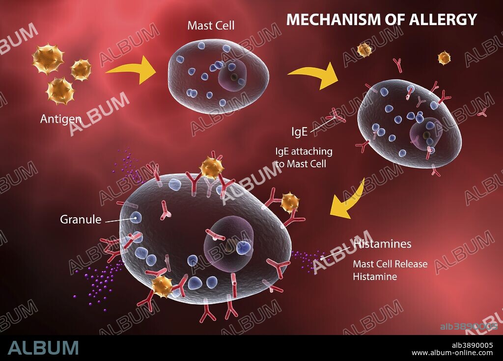 Mast cell releasing histamine due to allergic reaction.