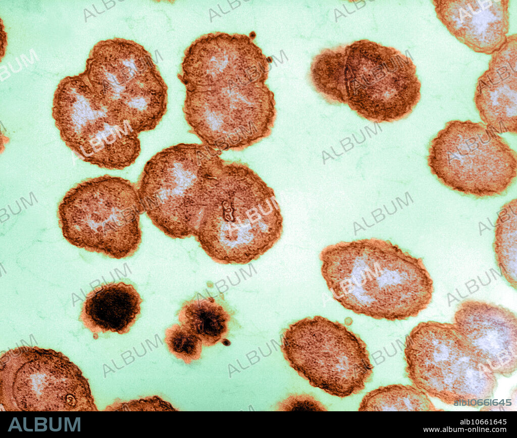 Electron micrograph of Neisseria gonorrhoeae, an aerobic gram-negative bacterium responsible for the sexually transmitted disease Gonorrhea. Approximate magnification: 100,000X.