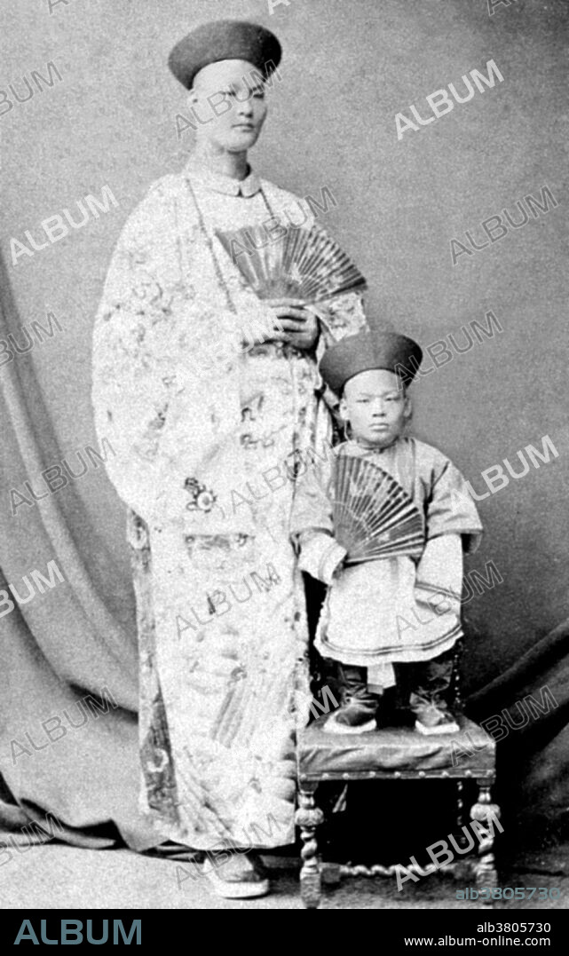 Chang Yu-sing the Chinese giant, and Chung Mow, a dwarf. Zhan Shichai AKA Chang Woo Gow (1841/47 - November 5, 1893) was a Chinese giant. His height was claimed to be over 8 feet, but there are no authoritative records. He left China in 1865 to travel to London where he appeared on stage, later travelling around Europe, and to the US and Australia as "Chang the Chinese Giant". Zhan received a good education in various countries, and developed a good understanding of ten languages. In America, he earned a salary of $500 a month. Kin Foo, the Chinese wife who accompanied Zhan from China, died in 1871, and Zhan later married Catherine Santley, a Liverpudlian whom he met in Sydney, Australia. They had two children: Edwin, and Ernest. In 1878, Zhan retired from the stage and settled in Bournemouth, where he opened a Chinese teahouse and a store selling Chinese imports. He died in 1893 and his coffin was 8 feet 6 inches long. Gigantism, also known as giantism, is a condition characterized by excessive growth and height significantly above average. In humans, this condition is caused by over-production of growth hormone in childhood resulting in persons between 7 feet and 9 feet tall.