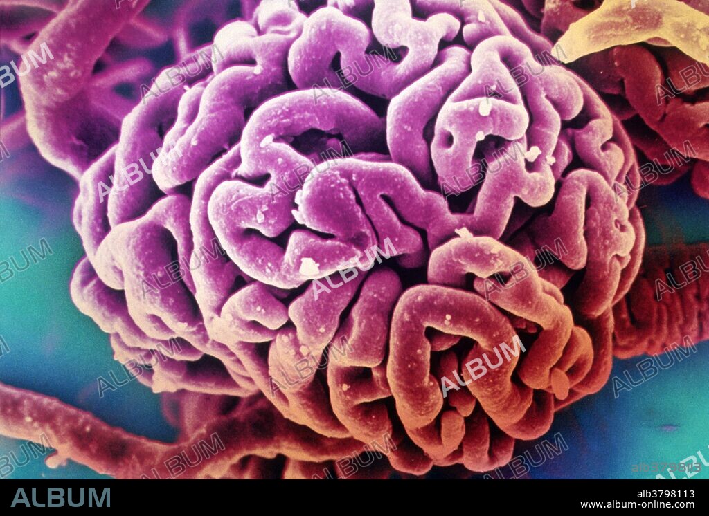 Color-enhanced scanning electron micrograph of mammalian kidney glomeruli. A glomerulus is a capillary ball-shaped structure in the kidney that aids in the formation of urine. Magnification: x350.