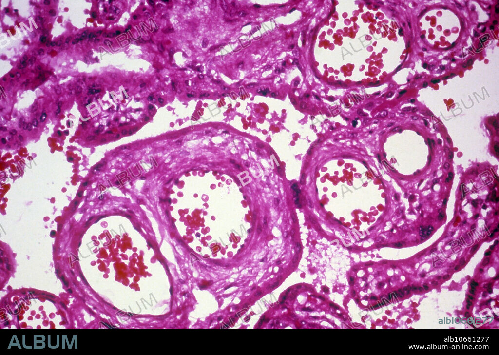 Light micrograph (LM) showing a transverse section of a human placenta with many blood vessels. Magnification unknown.